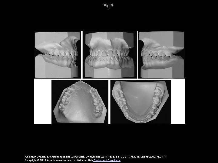 Fig 9 American Journal of Orthodontics and Dentofacial Orthopedics 2011 139533 -543 DOI: (10.