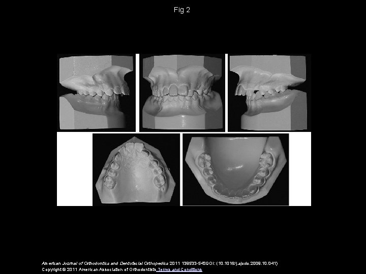 Fig 2 American Journal of Orthodontics and Dentofacial Orthopedics 2011 139533 -543 DOI: (10.