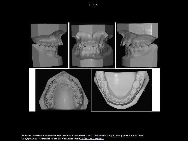 Fig 5 American Journal of Orthodontics and Dentofacial Orthopedics 2011 139533 -543 DOI: (10.