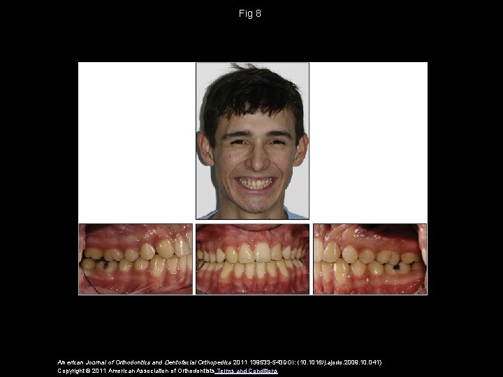 Fig 8 American Journal of Orthodontics and Dentofacial Orthopedics 2011 139533 -543 DOI: (10.