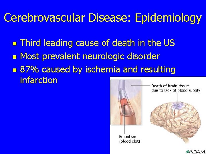 Cerebrovascular Disease: Epidemiology n n n Third leading cause of death in the US