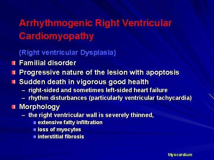 Arrhythmogenic Right Ventricular Cardiomyopathy (Right ventricular Dysplasia) Familial disorder Progressive nature of the lesion