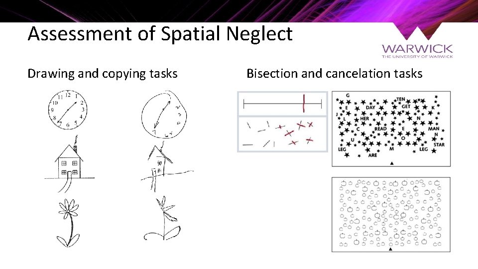 Assessment of Spatial Neglect Drawing and copying tasks Bisection and cancelation tasks 