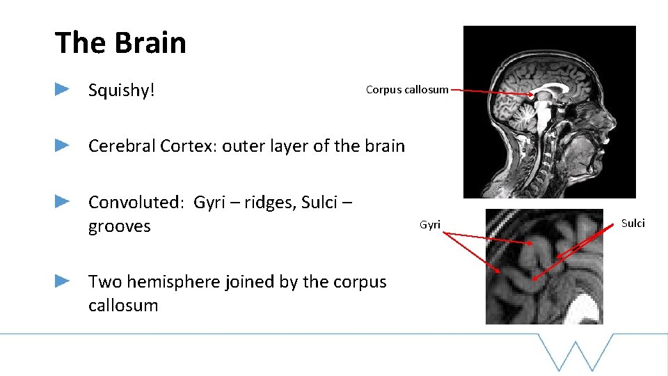 The Brain Squishy! Corpus callosum Cerebral Cortex: outer layer of the brain Convoluted: Gyri