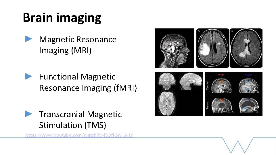 Brain imaging Magnetic Resonance Imaging (MRI) Functional Magnetic Resonance Imaging (f. MRI) Transcranial Magnetic