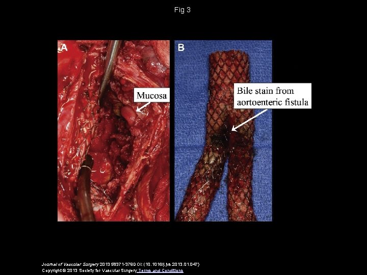 Fig 3 Journal of Vascular Surgery 2013 58371 -379 DOI: (10. 1016/j. jvs. 2013.