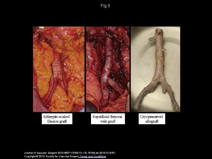 Fig 5 Journal of Vascular Surgery 2013 58371 -379 DOI: (10. 1016/j. jvs. 2013.