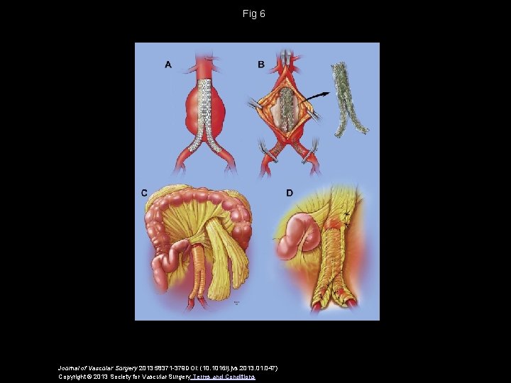 Fig 6 Journal of Vascular Surgery 2013 58371 -379 DOI: (10. 1016/j. jvs. 2013.