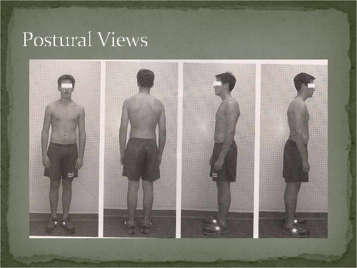 Postural Views 