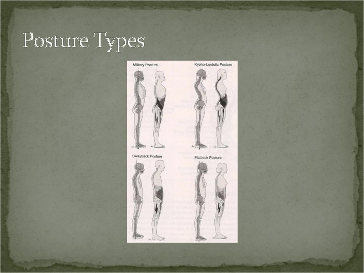 Posture Types 
