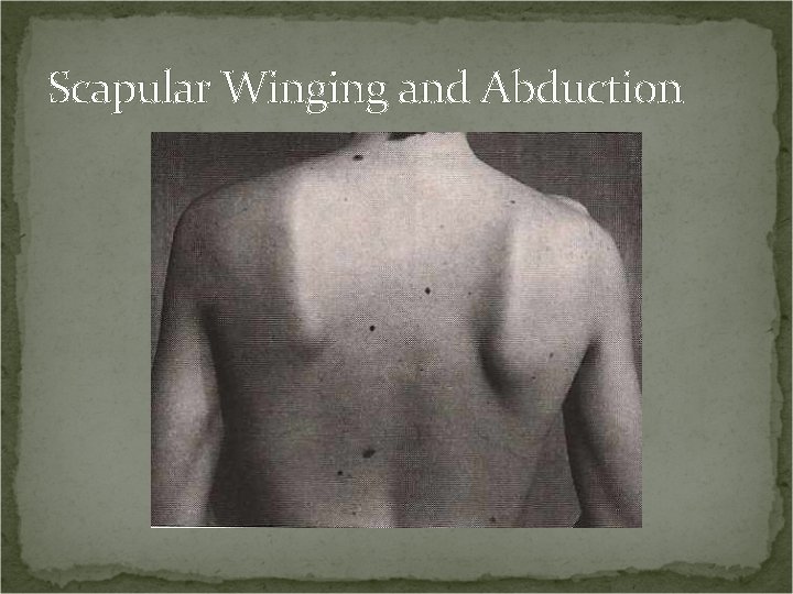 Scapular Winging and Abduction 