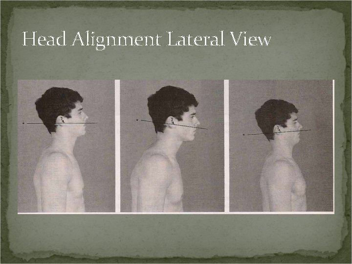 Head Alignment Lateral View 