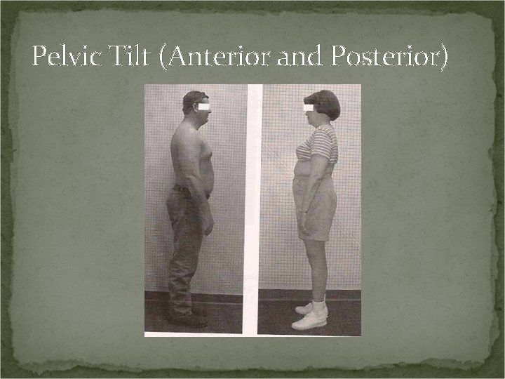 Pelvic Tilt (Anterior and Posterior) 