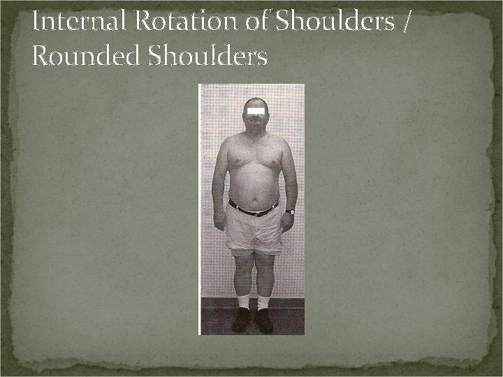 Internal Rotation of Shoulders / Rounded Shoulders 