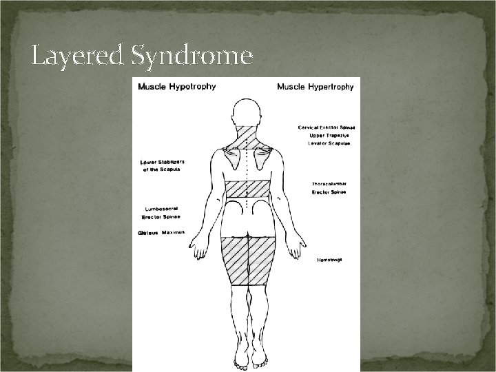 Layered Syndrome 