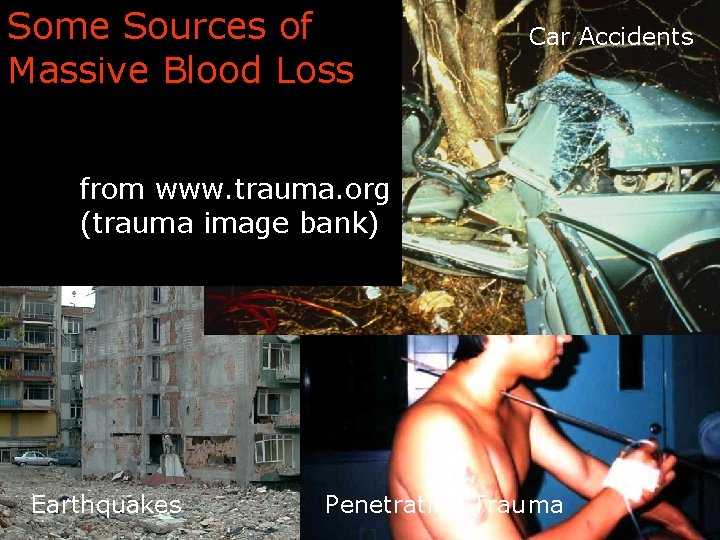 Some Sources of Massive Blood Loss Car Accidents from www. trauma. org (trauma image