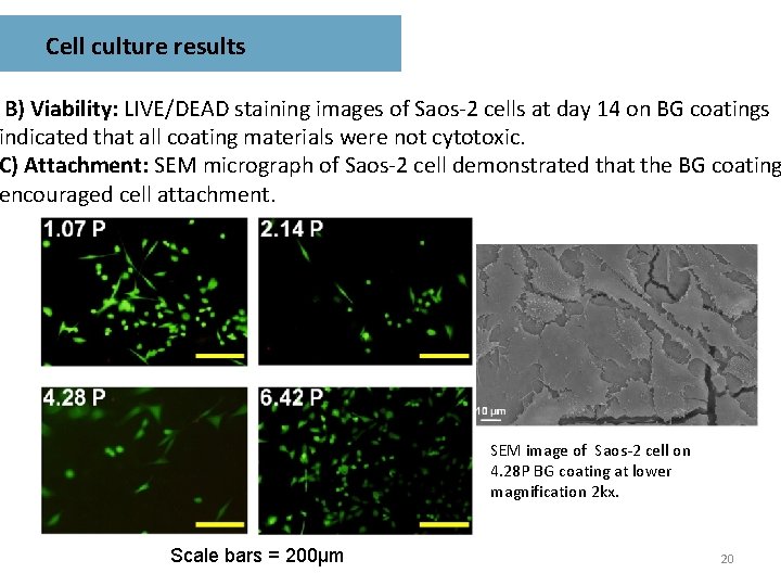 Cell culture results B) Viability: LIVE/DEAD staining images of Saos-2 cells at day 14