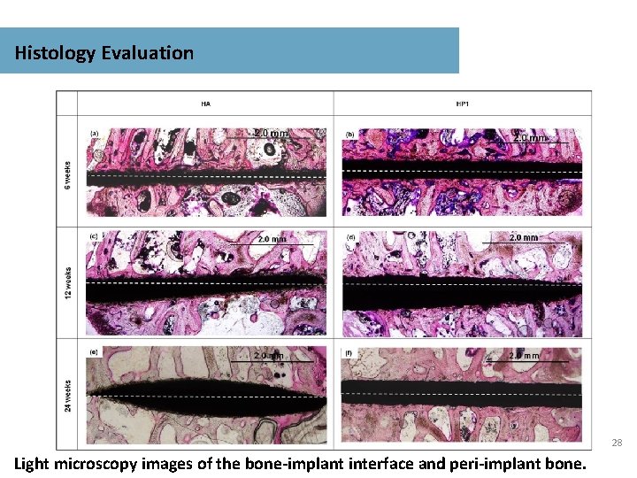 Histology Evaluation 28 Light microscopy images of the bone-implant interface and peri-implant bone. 