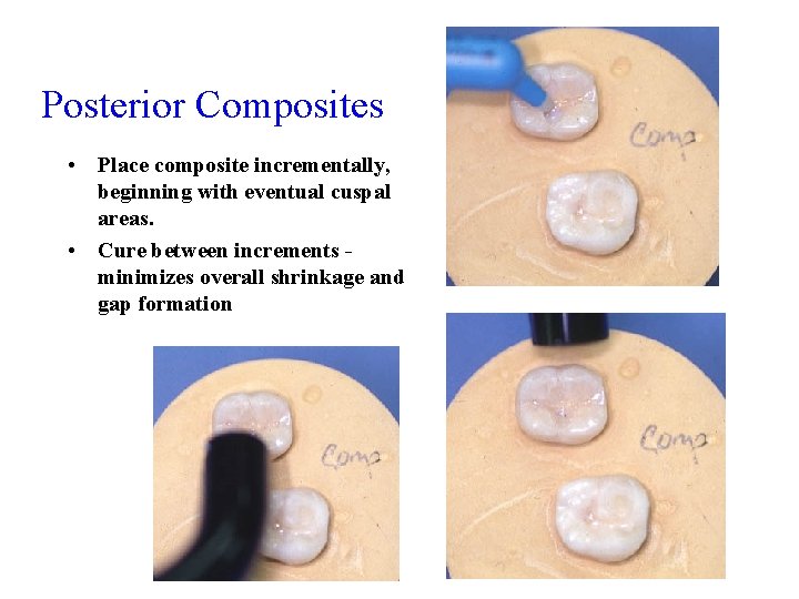 Posterior Composites • Place composite incrementally, beginning with eventual cuspal areas. • Cure between