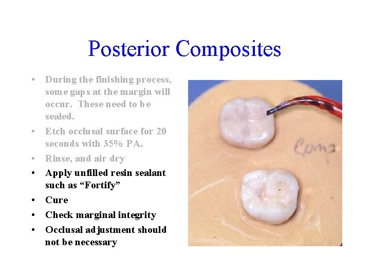 Posterior Composites • During the finishing process, some gaps at the margin will occur.