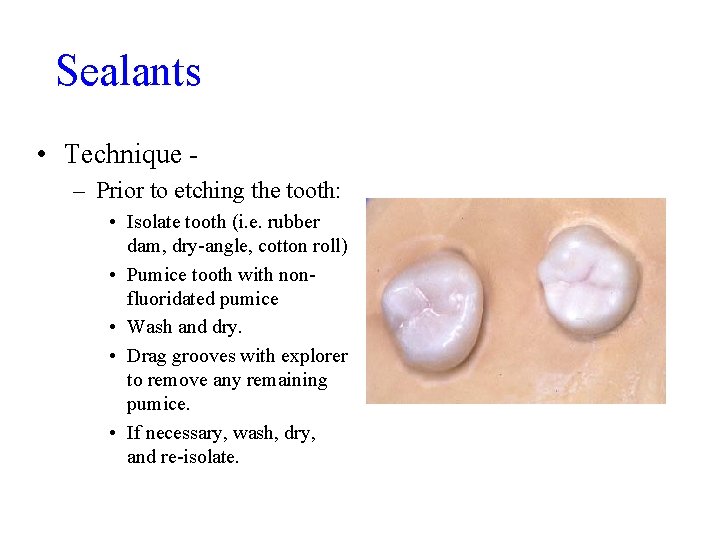 Sealants • Technique – Prior to etching the tooth: • Isolate tooth (i. e.