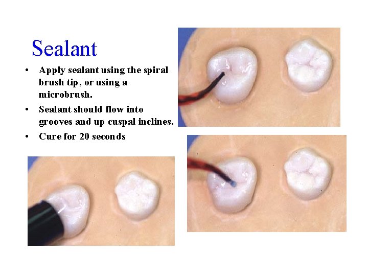 Sealant • Apply sealant using the spiral brush tip, or using a microbrush. •