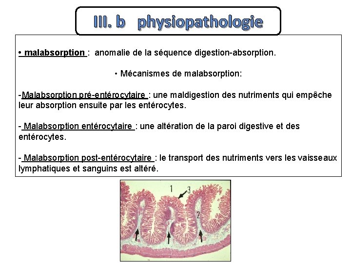 III. b physiopathologie • malabsorption : anomalie de la séquence digestion-absorption. • Mécanismes de