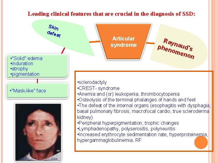 Leading clinical features that are crucial in the diagnosis of SSD: Skin defe a