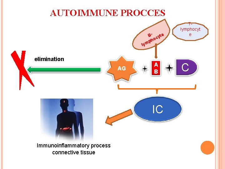 AUTOIMMUNE PROCCES В- cyte o ph m ly elimination AG A B IC Immunoinflammatory