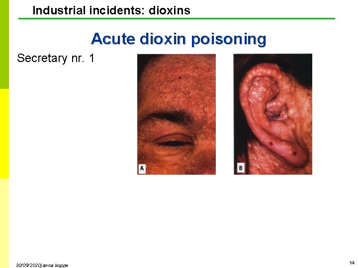 Industrial incidents: dioxins Acute dioxin poisoning Secretary nr. 1 30/09/2020 janna koppe 14 