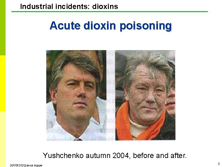 Industrial incidents: dioxins Acute dioxin poisoning Yushchenko autumn 2004, before and after. 30/09/2020 janna