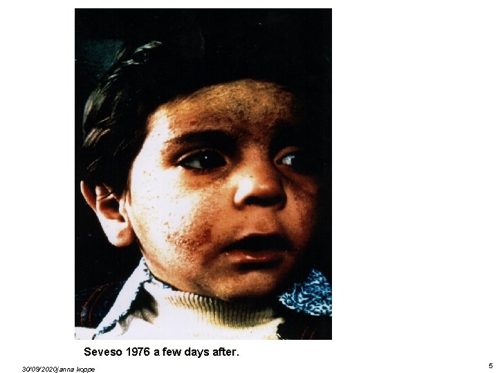 Seveso 1976 a few days after. 30/09/2020 janna koppe 5 Seveso 1976 a few days after. 30/09/2020 janna koppe 5