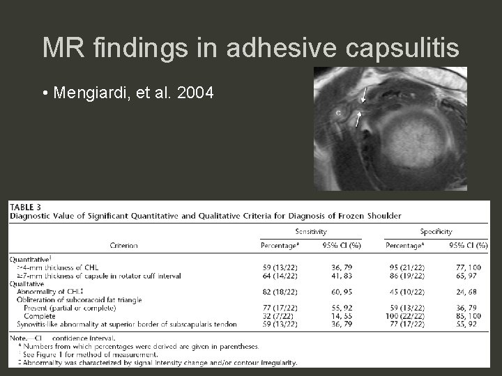 MR findings in adhesive capsulitis • Mengiardi, et al. 2004 