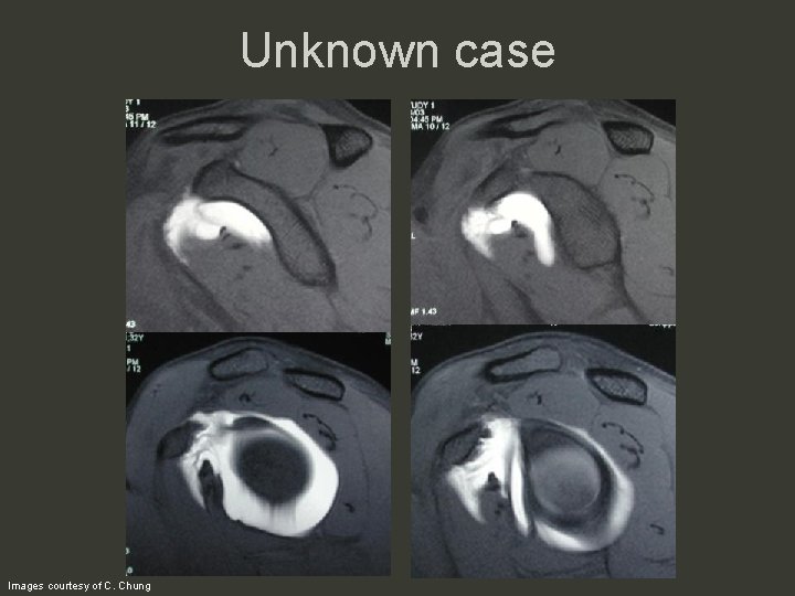 Unknown case Images courtesy of C. Chung 