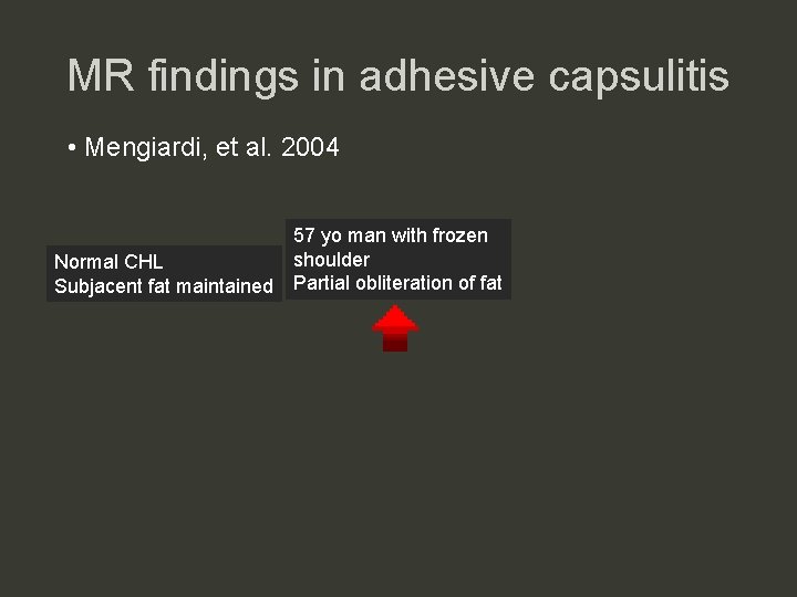 MR findings in adhesive capsulitis • Mengiardi, et al. 2004 Normal CHL Subjacent fat