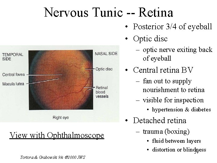 Nervous Tunic -- Retina • Posterior 3/4 of eyeball • Optic disc – optic