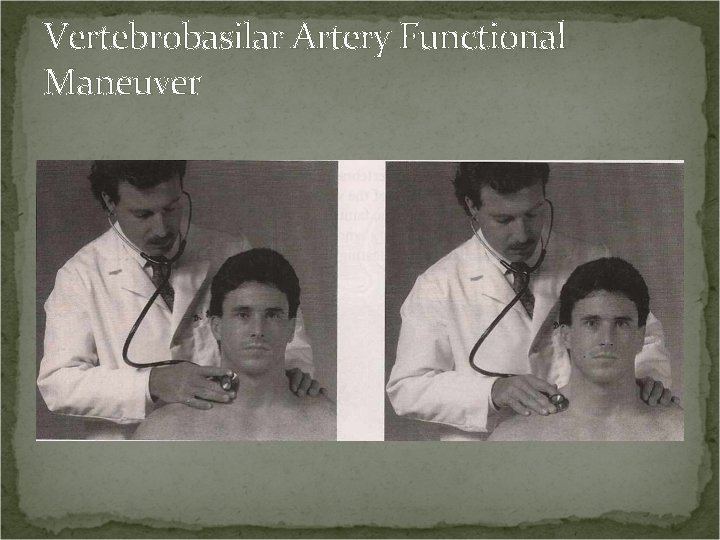 Vertebrobasilar Artery Functional Maneuver 