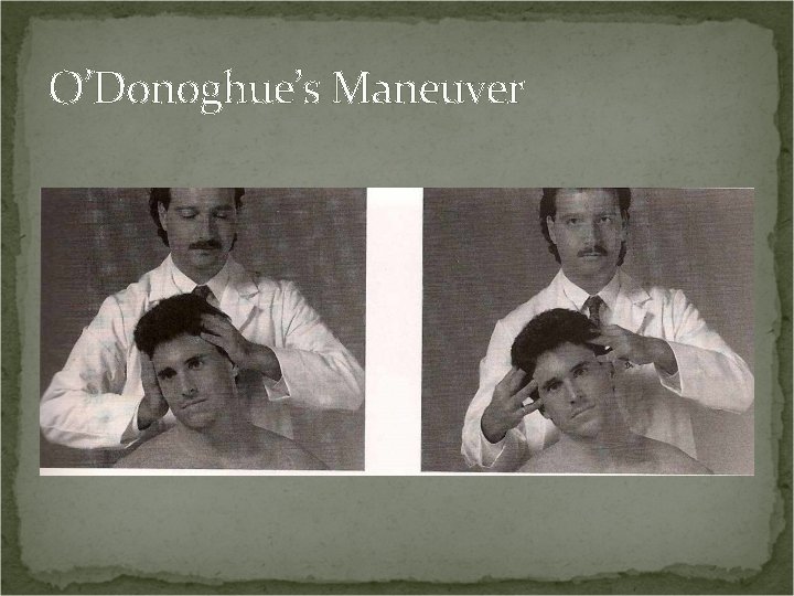 O’Donoghue’s Maneuver 