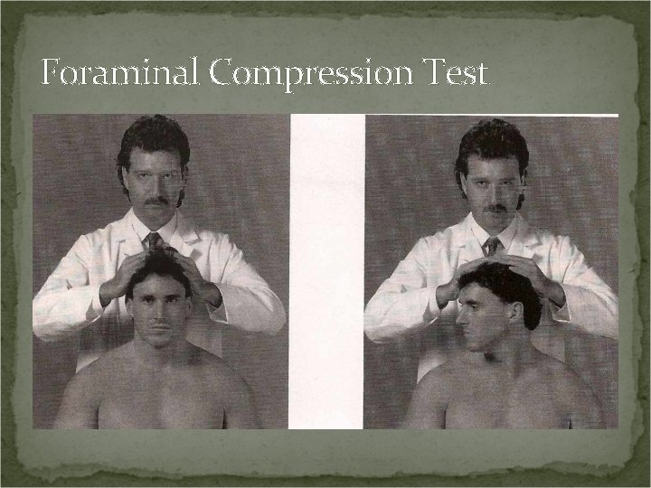 Foraminal Compression Test 