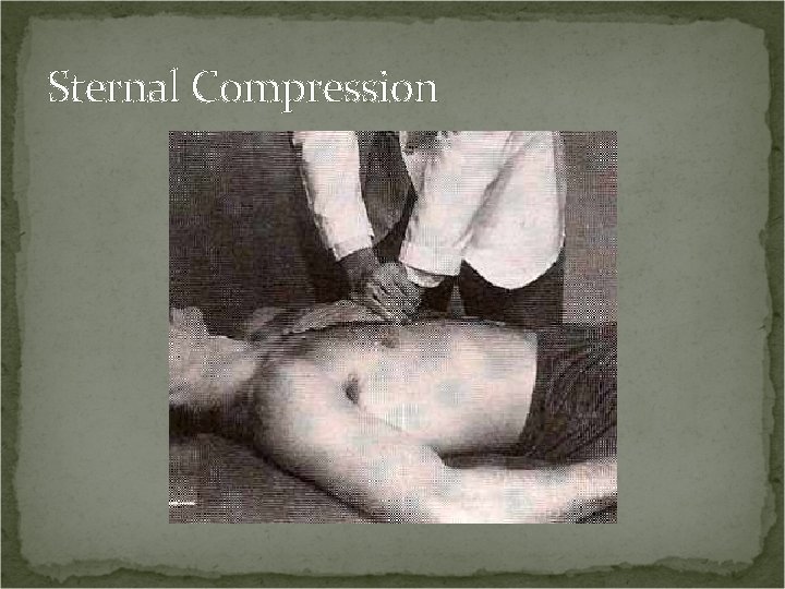 Sternal Compression 