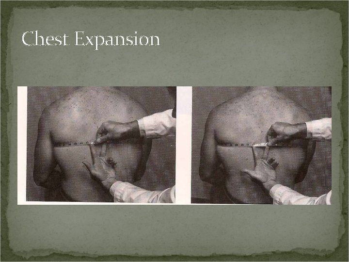 Chest Expansion Chest Expansion