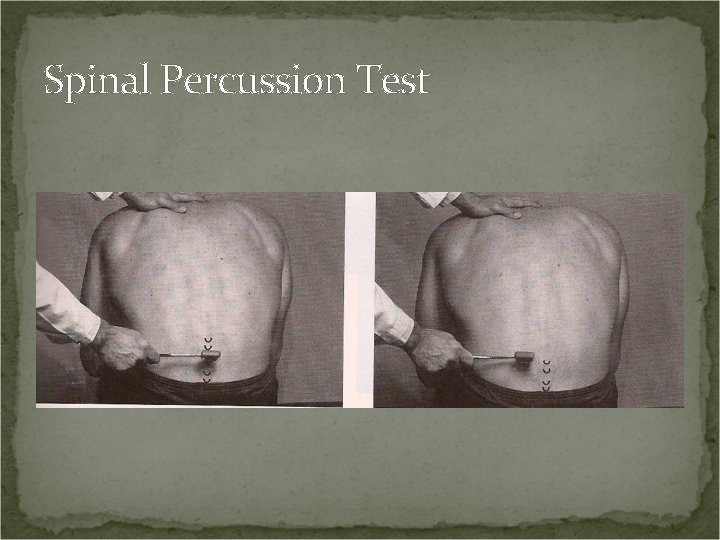 Spinal Percussion Test 