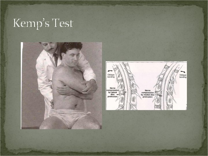 Kemp’s Test 