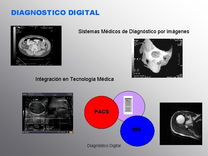 DIAGNOSTICO DIGITAL Sistemas Médicos de Diagnóstico por imágenes Integración en Tecnología Médica PACS RIS