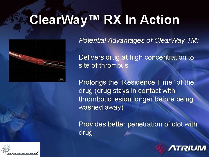 Clear. Way™ RX In Action Potential Advantages of Clear. Way TM: Delivers drug at
