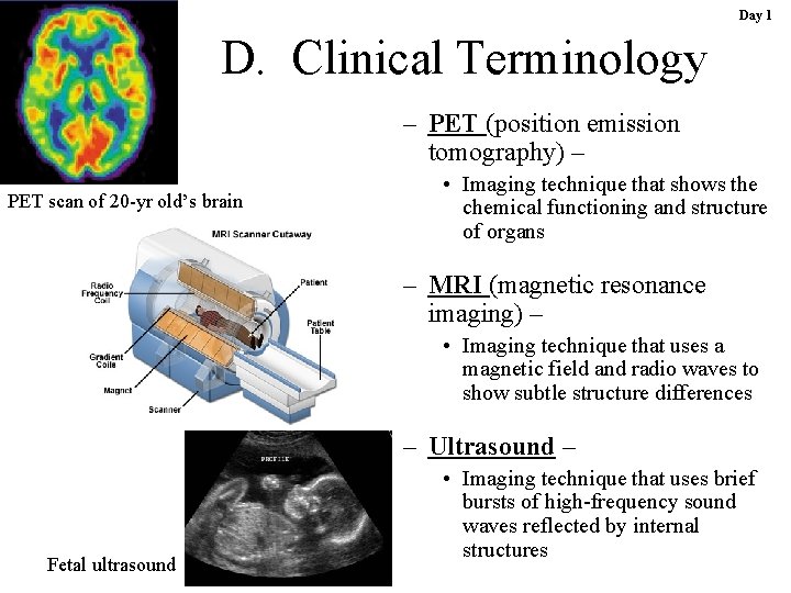 Day 1 D. Clinical Terminology – PET (position emission tomography) – PET scan of