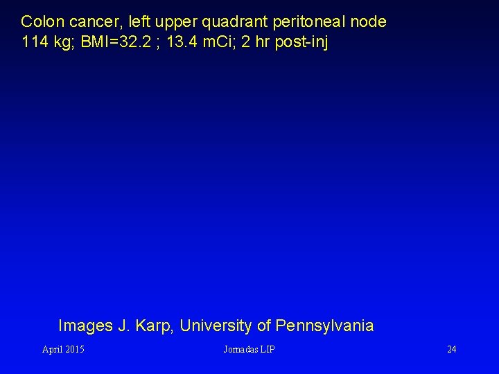 Colon cancer, left upper quadrant peritoneal node 114 kg; BMI=32. 2 ; 13. 4