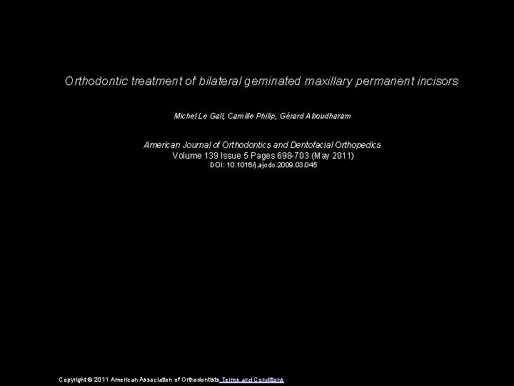 Orthodontic treatment of bilateral geminated maxillary permanent incisors Michel Le Gall, Camille Philip, Gérard