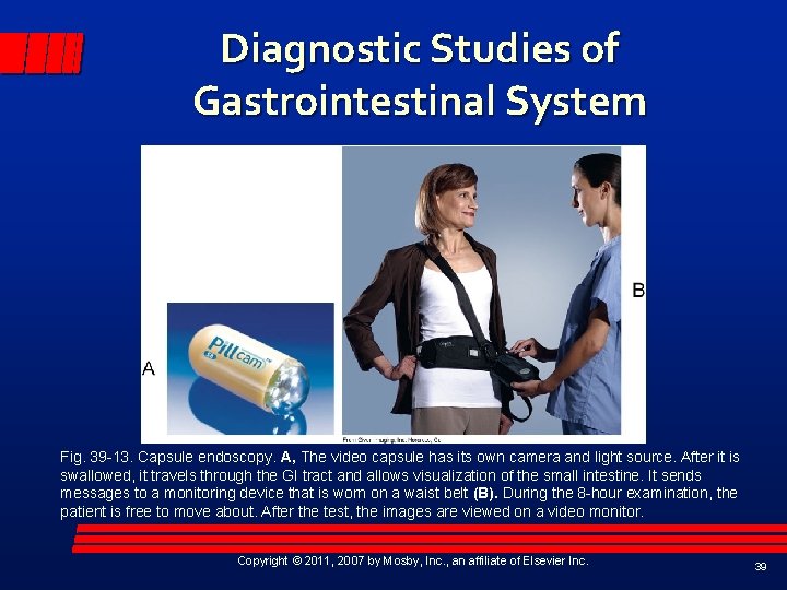 Diagnostic Studies of Gastrointestinal System Fig. 39 -13. Capsule endoscopy. A, The video capsule