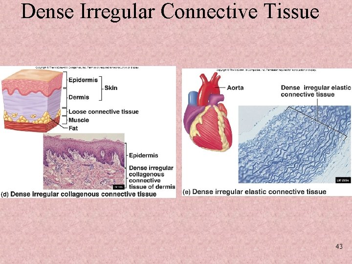 Dense Irregular Connective Tissue 43 